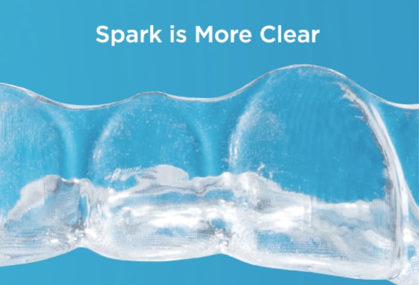 Spark aligner in place on the teeth, barely visible